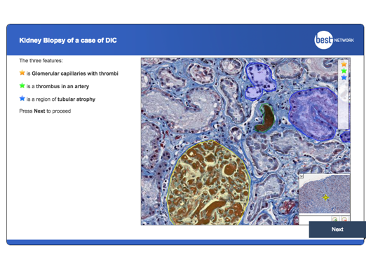 Another Adaptive Pathology lesson screenshot