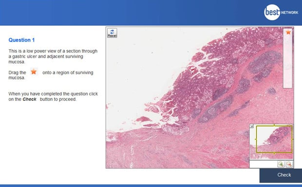 Virtual microscopy VMAT example